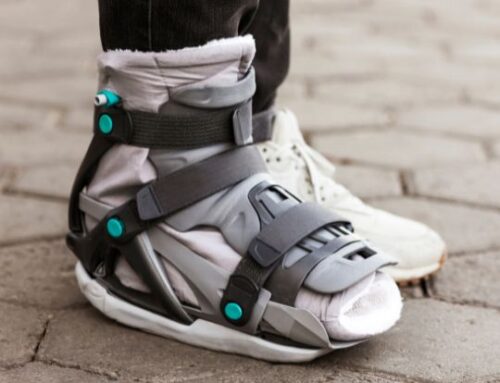 When to Use a Foot Brace