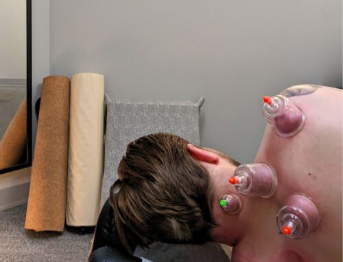 Myofascial Decompression: A Modern Approach to Fascial Health