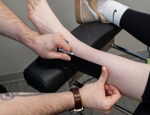 Tarsal Tunnel Syndrome in Dance